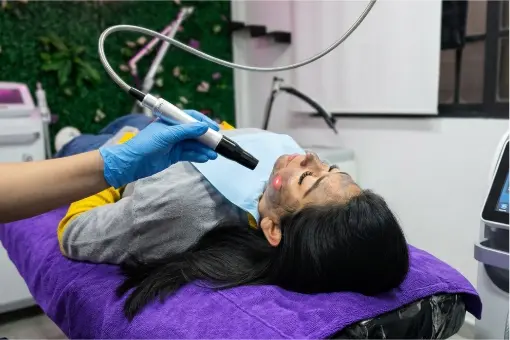 Rejuvenecimiento facial con tecnología láser